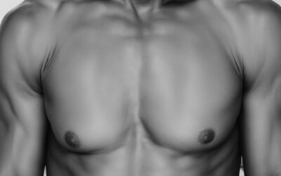 Mengatasi Selangkangan Gelap Akibat Keringat Berlebih